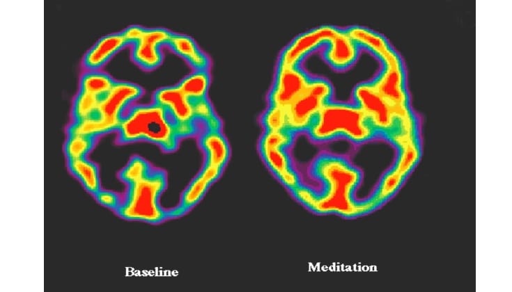 Brain scan comparison showing activated regions during third eye meditation